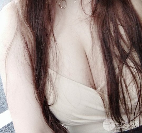 瑞美薈醫(yī)療美容診所薛瑞院長假體隆胸豐胸案例展示果