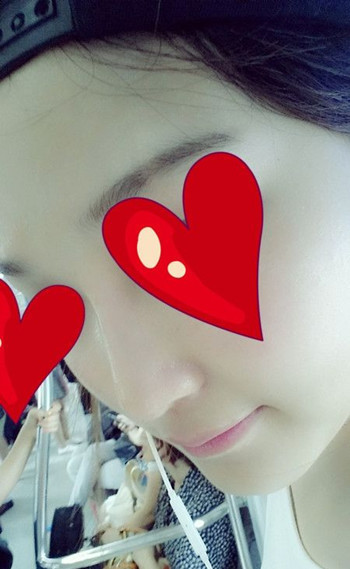 注射打玻尿酸隆鼻前后對比果照片圖 注射打玻尿酸隆鼻可以能夠維持多久