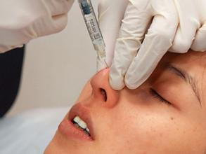 注射玻尿酸隆鼻前后應(yīng)注意什么