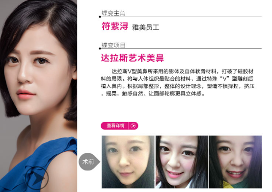 進(jìn)口膨體,進(jìn)口豐胸