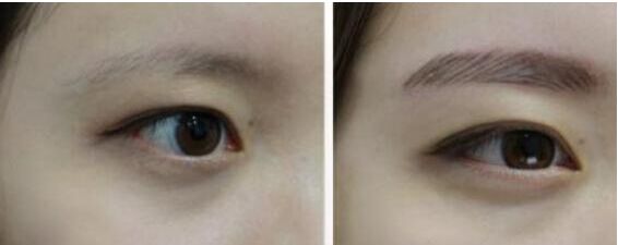 種植眉毛果圖片