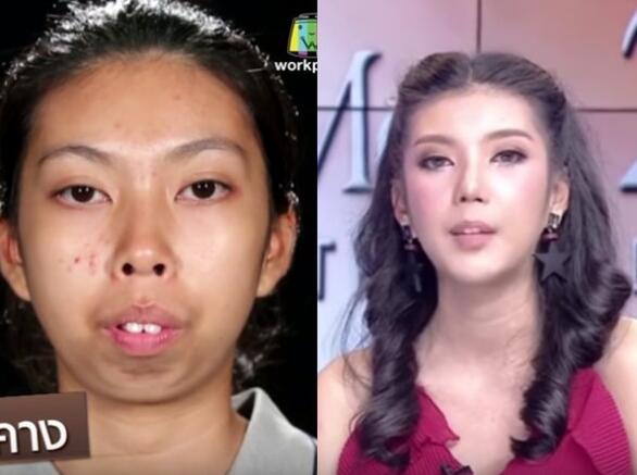 泰國(guó),暴牙妹,整容,**,超出想象