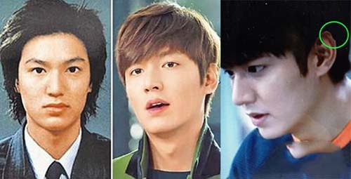 特別曝光李敏鎬整容前后對(duì)比照片