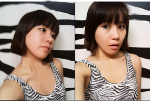 為大家分享我在北京301醫(yī)院做下頜角整形的真實歷程