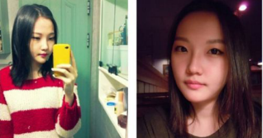 和大家分享北京301醫(yī)院做的下頜角整形真實(shí)經(jīng)