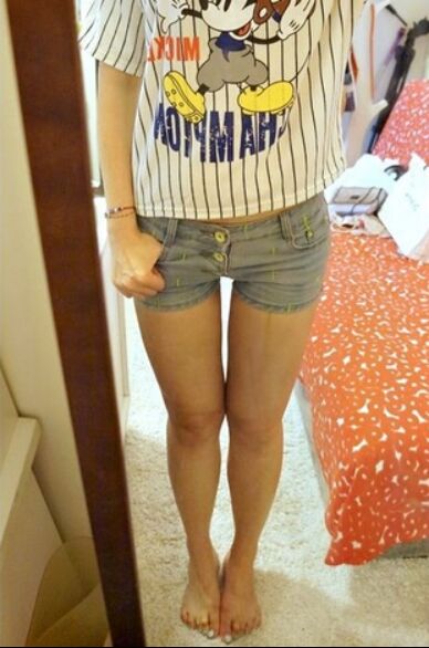 吸脂瘦大腿讓我變回纖纖細腿