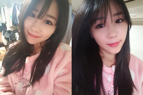 我做高強(qiáng)度聚焦超聲面b提升真實(shí)經(jīng)歷 繼續(xù)做我的少女