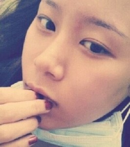 顴骨整形后我也變得甜美了