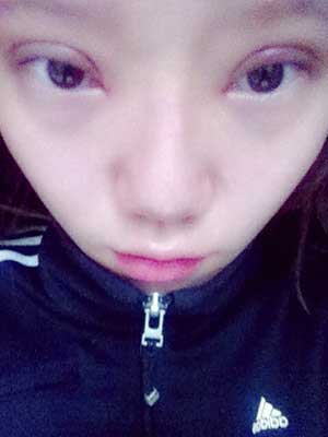 割雙眼皮半個月了 有雙眼皮的感覺真爽！