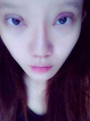 割雙眼皮半個月了 有雙眼皮的感覺真爽！