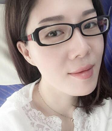 雙眼皮恢復(fù)記錄 果很滿意~