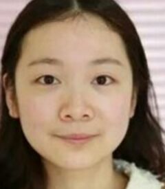 全切雙眼皮讓我眼睛變得更大更有神