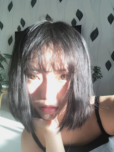 成都玉之光頭發(fā)移植 果杠杠的~