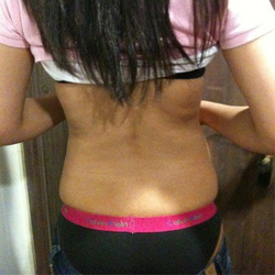 北京禾美嘉腹部吸脂 可以自信地秀出小蠻腰啦！