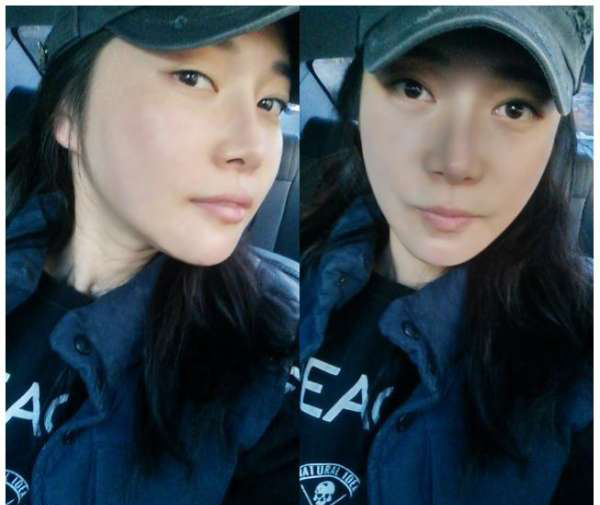 柳大烈給我做的改臉型手術(shù) 求圍觀!