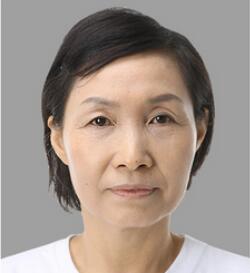 做了電波l皮除皺年輕了十多歲 杭州同欣做的很不錯(cuò)哦