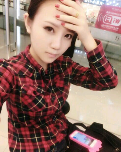 假體隆鼻15天后恢復(fù)果 杭州時光做的~