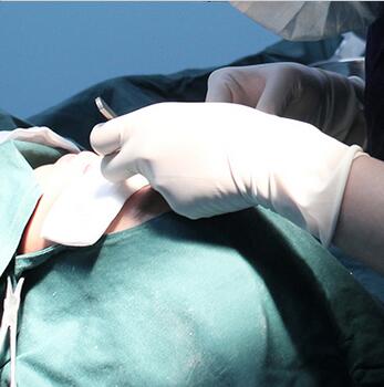 雙眼皮手術(shù)讓我單眼皮變雙眼皮就是這么簡單