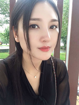 北京常好麗格做假體隆鼻3個月