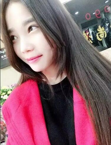 成都蜀尚蓉雅雙眼皮恢復(fù)紀(jì)實(shí) 看看果怎么樣