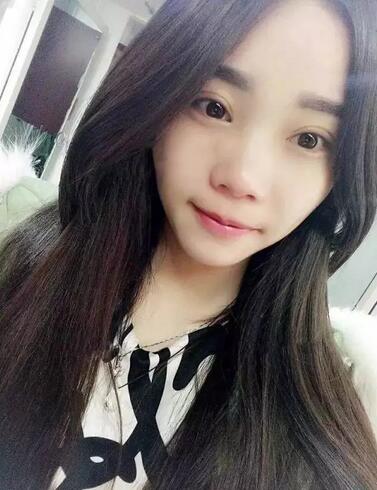 成都蜀尚蓉雅雙眼皮恢復(fù)紀(jì)實(shí) 看看果怎么樣