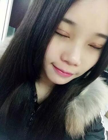 成都蜀尚蓉雅雙眼皮恢復(fù)紀(jì)實(shí) 看看果怎么樣