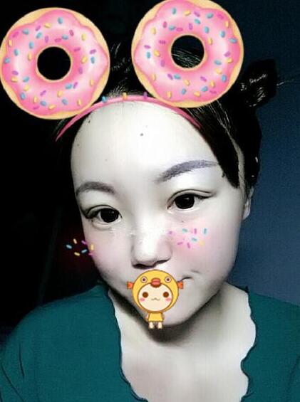 雙眼皮恢復(fù)過(guò)程分享
