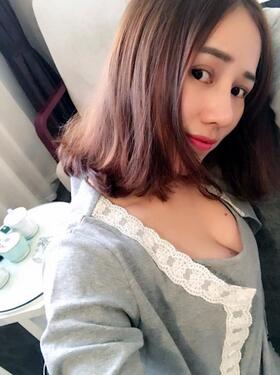 蜀尚蓉雅自體脂肪豐胸2個(gè)月啦~