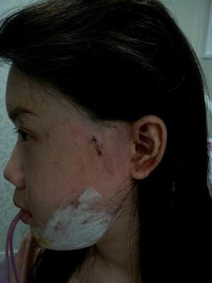 磨了下頜角和顴骨的我 變成小仙女了