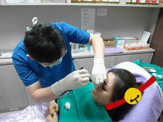 Misko隆鼻讓我鼻子變得挺拔嬌俏無壓力