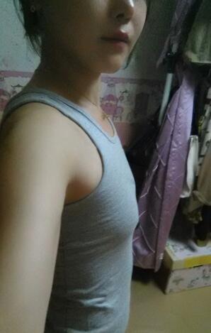 成都艾米麗自體脂肪隆胸三個(gè)月啦~