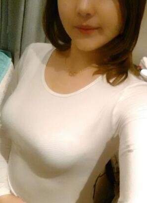 成都艾米麗自體脂肪隆胸三個(gè)月啦~