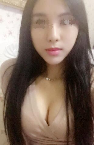 艾米麗自體脂肪隆胸恢復(fù)經(jīng)歷