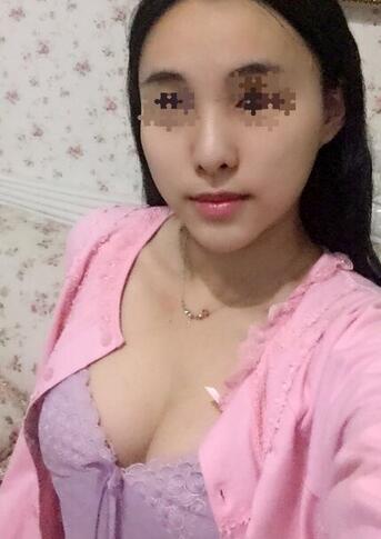 艾米麗自體脂肪隆胸恢復(fù)經(jīng)歷