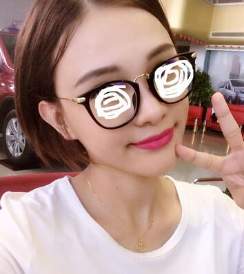 玻尿酸豐太陽7天果圖 愛悅麗格豐太陽穴一個月啦~