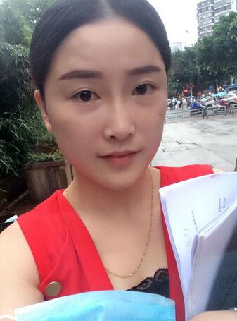 愛悅麗格玻尿酸豐蘋果肌、豐下巴、隆鼻