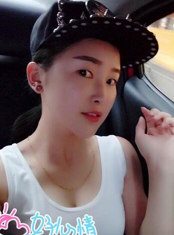 愛悅麗格玻尿酸豐蘋果肌、豐下巴、隆鼻