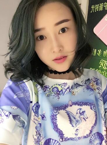 愛悅麗格玻尿酸豐蘋果肌、豐下巴、隆鼻