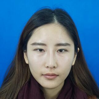 愛悅麗格膠原蛋白豐蘋果肌分享