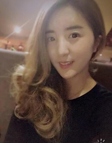 愛(ài)悅麗格玻尿酸豐臉頰日記分享