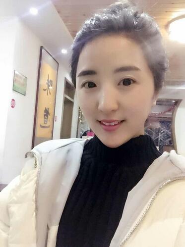 愛(ài)悅麗格玻尿酸豐臉頰日記分享