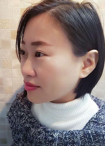 武漢中愛注射瘦臉去魚尾紋一個(gè)月