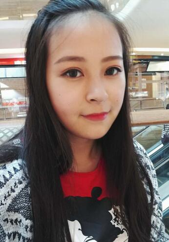 梨花雨割雙眼皮恢復(fù)半年了