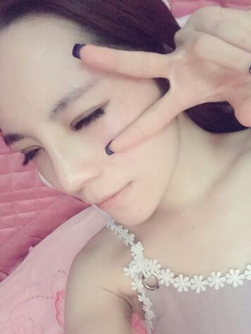 梨花雨隆鼻整形的恢復經(jīng)歷