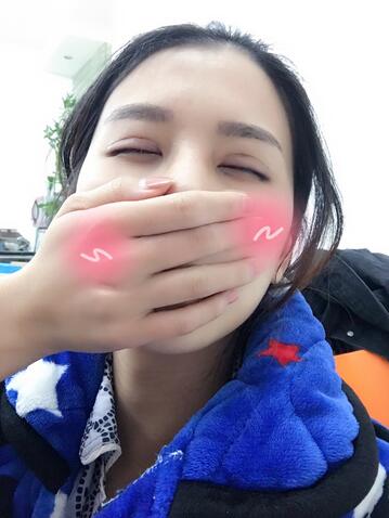 上海韓鏡割雙眼皮一個(gè)月