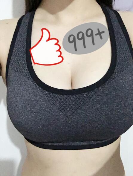 上海韓鏡曼托假體隆胸18天