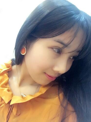 開(kāi)眼角加雙眼皮15天恢復(fù)圖