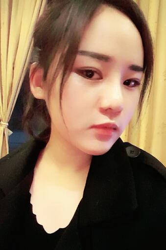 假體墊下巴一個月 前后對比