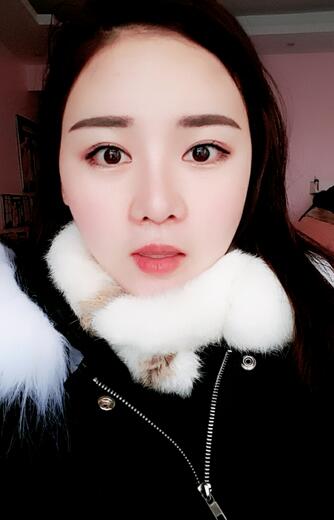 假體墊下巴一個月 前后對比