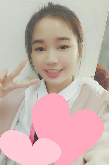 自體脂肪填充后十天圖